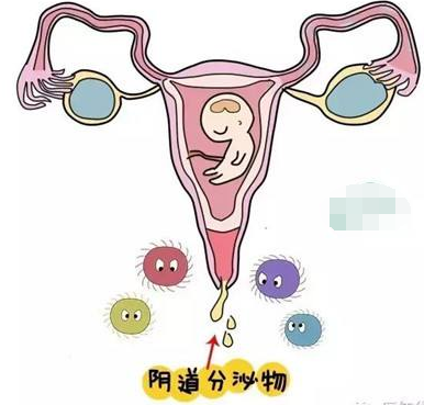 阴道分泌物91短视频免费下载的一般性状检查类型