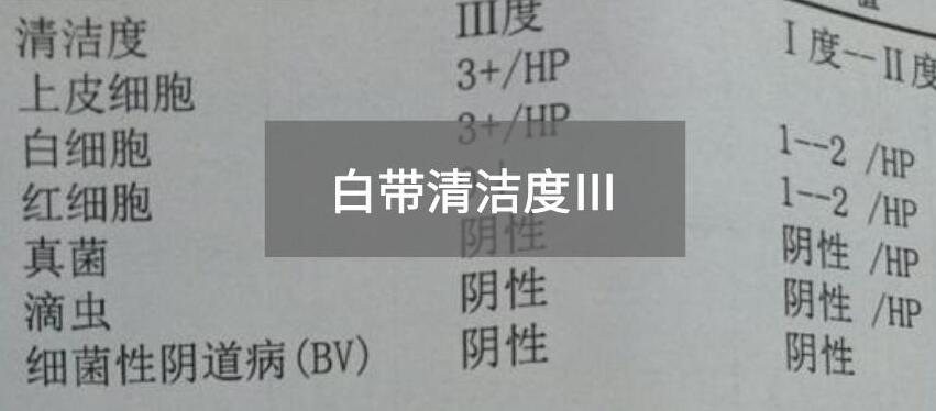 今天快讯！全自动白带91短视频在线观看经典下载生产厂家91短视频在线观看免费最新为您官方解释白带清洁度3的意思