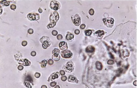 全自动阴道分泌物91短视频免费下载剖析阴道分泌物的洁净度规范