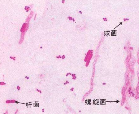 妇科白带91短视频免费下载厂家分析白带线索细胞阳性的意义