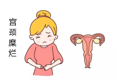 宫颈糜烂会导致宫颈癌?白带91短视频在线观看经典下载品牌：不要自己吓自己
