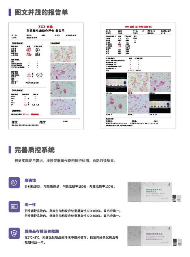 阴道分泌物91短视频在线观看经典下载V800报告单