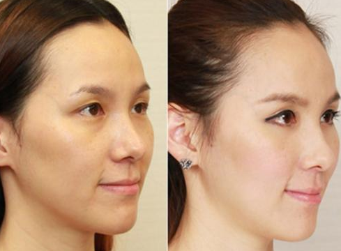 【全自动白带91短视频免费下载品牌91短视频在线观看免费最新】提示女性开端变老的身体警告